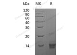 Recombinant Human Parathyroid Hormone/PTH Protein (1-84) - ABMIUM