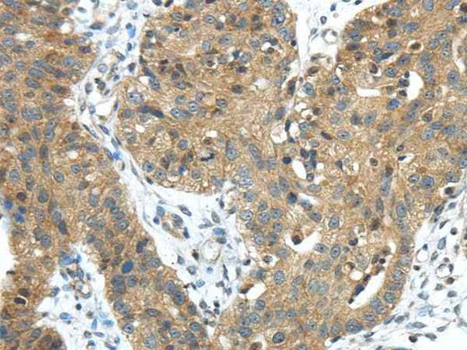 Anti-Human TMPRSS11E Antibody