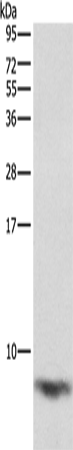 Anti-Human/Mouse/Rat FXYD1 Antibody - ABMIUM