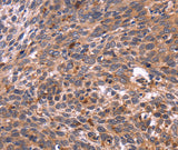 Anti-Human/Mouse/Rat CRK Antibody - ABMIUM