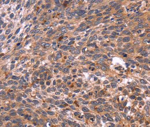 Anti-Human/Mouse/Rat CRK Antibody