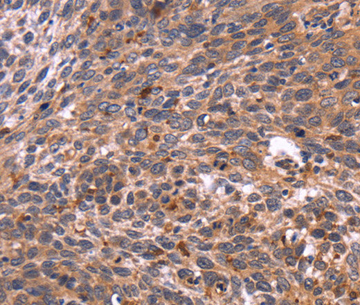 Anti-Human/Mouse/Rat CRK Antibody - ABMIUM