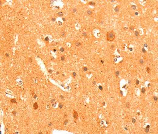 Anti-Human/Mouse/Rat GRM3 Antibody