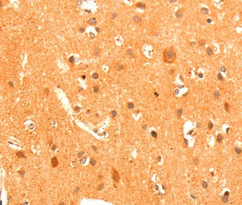 Anti-Human/Mouse/Rat GRM3 Antibody - ABMIUM