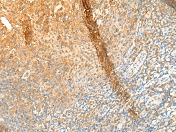 Immunohistochemistry of paraffin-embedded Human tonsil tissue using GPR162 Polyclonal Antibody at dilution of 1:65(×200)