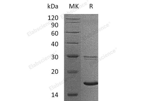 Recombinant Human UBE2B/HR6B Protein (His Tag) - ABMIUM