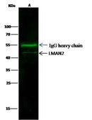 Anti-Human LMAN2 Antibody [A980] - ABMIUM