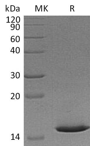 Recombinant Mouse Cystatin 8/CST8 Protein (His Tag) - ABMIUM