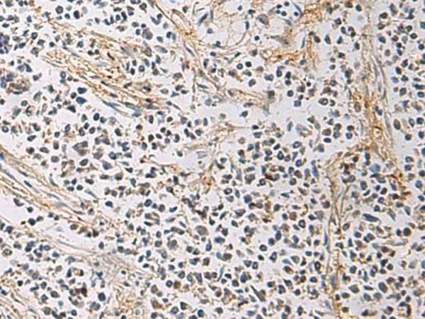 Anti-Human/Mouse/Rat GMPR Antibody