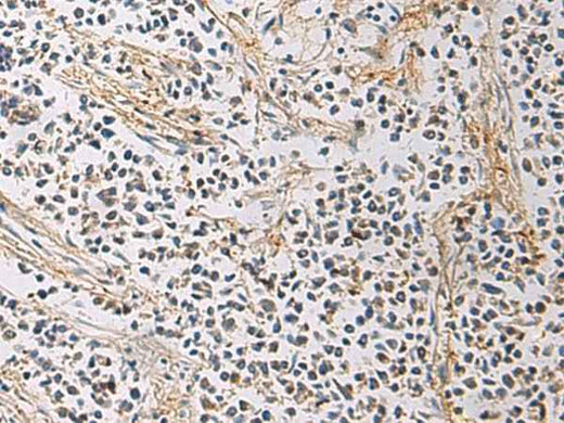 Anti-Human/Mouse/Rat GMPR Antibody