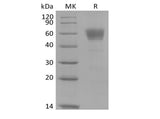 Recombinant Cynomolgus IL-3 Receptor Subunit Alpha/IL-3RA/CD123 (C-Fc) - ABMIUM