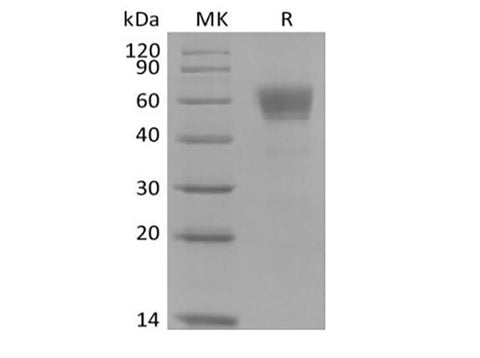 Recombinant Cynomolgus IL-3 Receptor Subunit Alpha/IL-3RA/CD123 (C-Fc) - ABMIUM