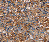 Anti-Human/Mouse NEDD4L Antibody - ABMIUM