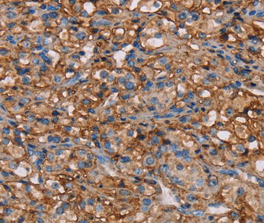 Anti-Human/Mouse NEDD4L Antibody - ABMIUM