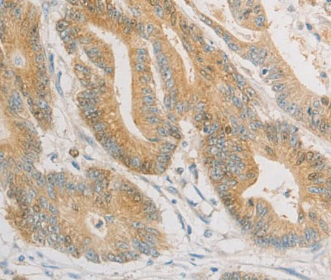 Anti-Human ZWINT Antibody - ABMIUM