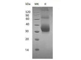 Recombinant Mouse NKG2DL/ULBP-1 Protein (His Tag) - ABMIUM