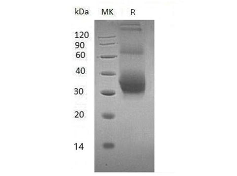 Recombinant Mouse NKG2DL/ULBP-1 Protein (His Tag) - ABMIUM