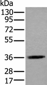 Western blot analysis of Jurkat cell lysate using ACAT2 Polyclonal Antibody at dilution of 1:550