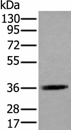 Western blot analysis of Jurkat cell lysate using ACAT2 Polyclonal Antibody at dilution of 1:550