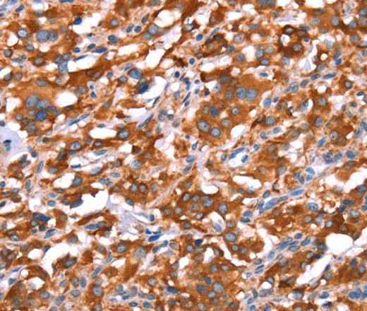 Anti-Human/Mouse/Rat GAS8 Antibody