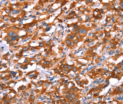 Anti-Human/Mouse/Rat GAS8 Antibody - ABMIUM