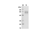 SDS-PAGE analysis of Mouse CD14 proteins, 2 μg/lane of Recombinant Mouse CD14 proteins was resolved with SDS-PAGE under reducing conditions, showing bands at 50-62 kDa.