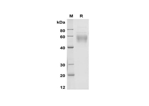 SDS-PAGE analysis of Mouse CD14 proteins, 2 μg/lane of Recombinant Mouse CD14 proteins was resolved with SDS-PAGE under reducing conditions, showing bands at 50-62 kDa.
