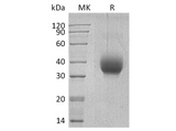 Recombinant Human SLAMF6/Ly108 Protein (aa 28-225, His Tag) - ABMIUM