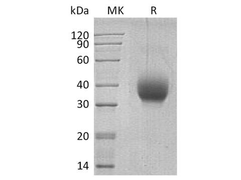 Recombinant Human SLAMF6/Ly108 Protein (aa 28-225, His Tag) - ABMIUM
