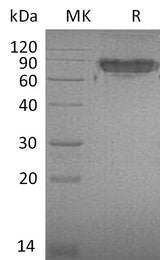 Recombinant Mouse ICAM-2/CD102 Protein (Fc Tag) - ABMIUM
