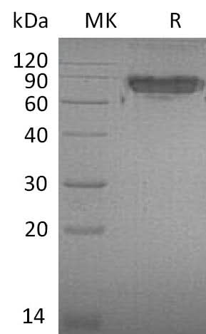 Recombinant Mouse ICAM-2/CD102 Protein (Fc Tag) - ABMIUM