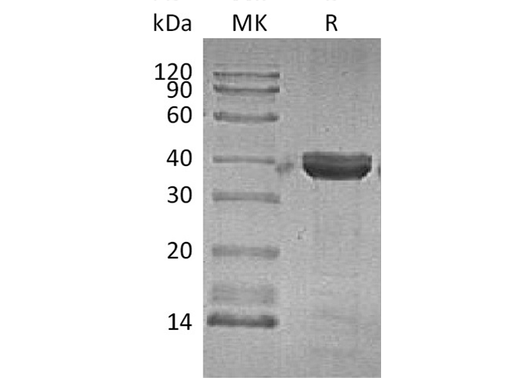 Recombinant Human Cathepsin Z Protein (His Tag) - ABMIUM