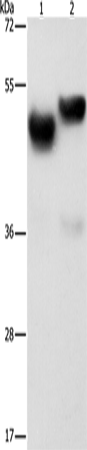 Anti-Human AMZ1 Antibody - ABMIUM