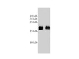Western blotting with anti-KRAS polyclonal Antibody at dilution of 1:1000. Lane 1: Hela cell lysates, lane 2: Mouse heart lysate.