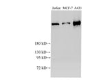 Western Blot analysis of Jurkat, MCF-7 and A431 cells using BRCA2 Polyclonal Antibody at dilution of 1:2000
