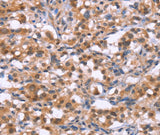 Anti-Human/Mouse BRK1 Antibody - ABMIUM