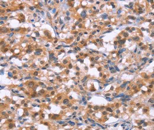 Anti-Human/Mouse BRK1 Antibody