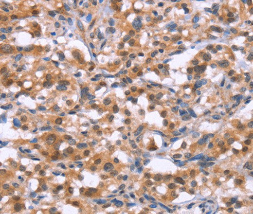 Anti-Human/Mouse BRK1 Antibody - ABMIUM
