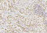 Anti-Human STK4 Antibody [B327]