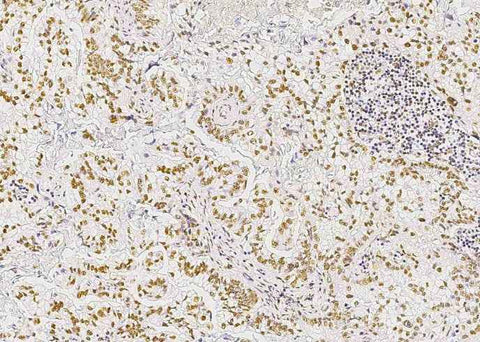 Anti-Human STK4 Antibody [B327] - ABMIUM