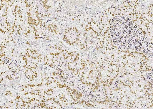 Anti-Human STK4 Antibody [B327] - ABMIUM