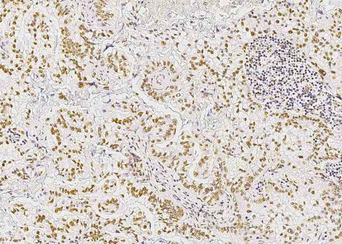 Anti-Human STK4 Antibody [B327]