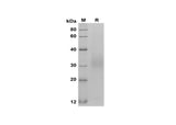 SDS-PAGE analysis of Rat Fas/TNFRSF6/CD95 proteins, 2 μg/lane of Recombinant Rat Fas/TNFRSF6/CD95 proteins was resolved with SDS-PAGE under reducing conditions, showing bands at 30-35 kDa.