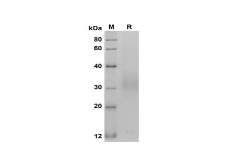 SDS-PAGE analysis of Rat Fas/TNFRSF6/CD95 proteins, 2 μg/lane of Recombinant Rat Fas/TNFRSF6/CD95 proteins was resolved with SDS-PAGE under reducing conditions, showing bands at 30-35 kDa.