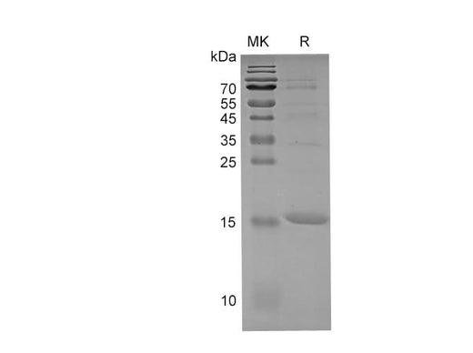 SDS-PAGE analysis of Rabbit IL1B proteins, 2 μg/lane of Recombinant Rabbit IL1B proteins was resolved with SDS-PAGE under reducing conditions, showing bands at 17 kDa.