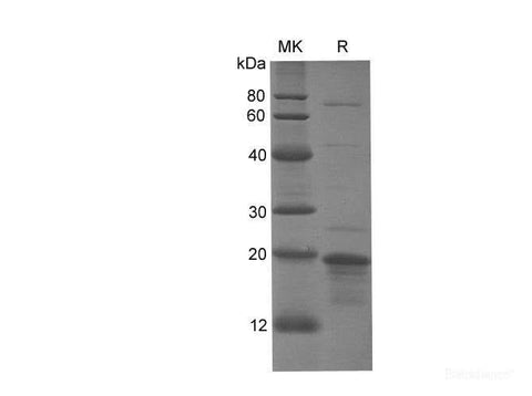 SDS-PAGE analysis of Human PPARG proteins, 2 μg/lane of Recombinant Human PPARG proteins was resolved with SDS-PAGE under reducing conditions, showing bands at 20 kDa.