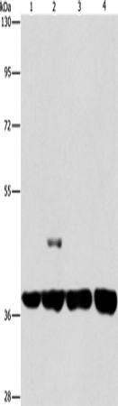Anti-Human SERPINA9 Antibody - ABMIUM