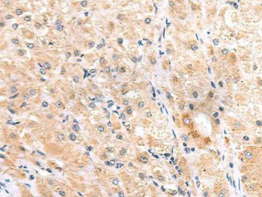 Anti-Human/Mouse ITGA3 Antibody