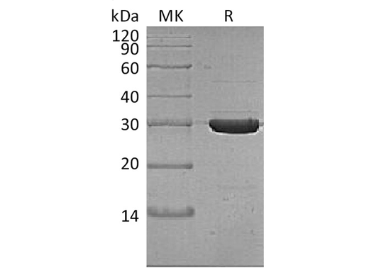 Recombinant Thermobifida fusca Cutinase Protein (His Tag) - ABMIUM