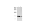 Anti-Mouse/Rat IFABP Antibody - ABMIUM